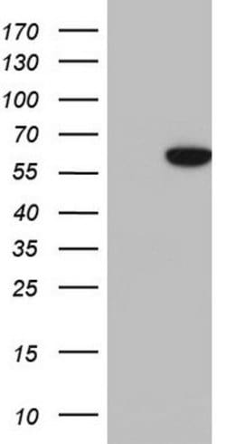 KRT7 Monoclonal Antibody (OTI1B6), TrueMAB , OriGene 100 &mu;L; Unconjugated:Antibodies,