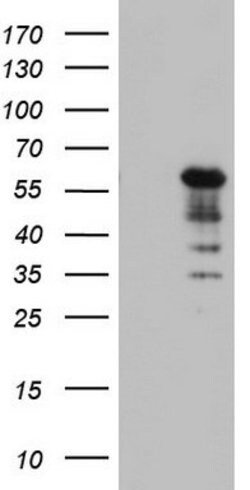 KRT7 Mouse anti-Human, Clone: OTI3B7, lyophilized, TrueMAB 100 &mu;g; Unconjugated:Antibodies,