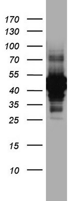 KRT7 Mouse anti-Human, Clone: OTI3B7, lyophilized, TrueMAB 100 &mu;g; Unconjugated:Antibodies,