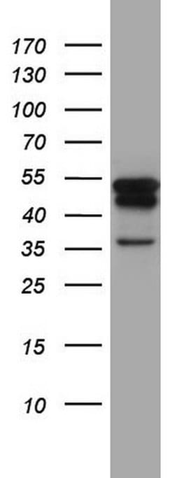 KRT7 Monoclonal Antibody (OTI2A2), TrueMAB , OriGene 100 &mu;L; Unconjugated:Antibodies,