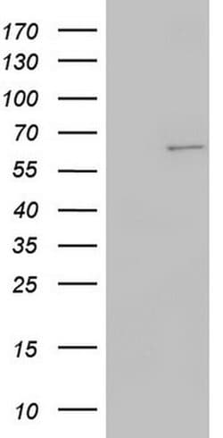 KRT7 Monoclonal Antibody (OTI2E11), TrueMAB , OriGene 100 &mu;L; Unconjugated:Antibodies,