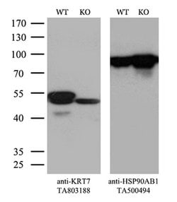 KRT7 Monoclonal Antibody (OTI2E11), TrueMAB , OriGene 100 &mu;L; Unconjugated:Antibodies,