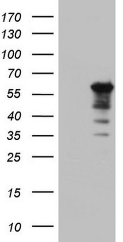 KRT7 Monoclonal Antibody (OTI2D1), TrueMAB , OriGene:Antibodies:Primary