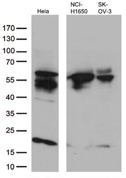 KRT7 Mouse anti-Human, Clone: OTI2D1, lyophilized, TrueMAB 100 &mu;g; Unconjugated:Antibodies,