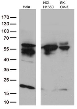KRT7 Monoclonal Antibody (OTI2D1), TrueMAB , OriGene 100 &mu;L | Buy Online | OriGene | Fisher Scientific