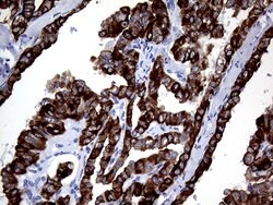 KRT8 Monoclonal Antibody (OTI2F5), TrueMAB , OriGene 30 &mu;L | Buy Online | Origene Technologies | Fisher Scientific