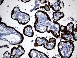 KRT84 Monoclonal Antibody (OTI2D1), TrueMAB , OriGene 100 &mu;L; Unconjugated:Antibodies,