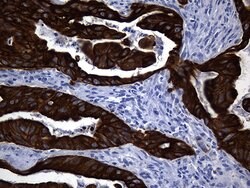 KRT84 Monoclonal Antibody (OTI2D1), TrueMAB , OriGene 100 &mu;L; Unconjugated:Antibodies,