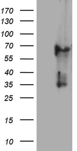 KRT84 Monoclonal Antibody (OTI2D1), TrueMAB , OriGene 100 &mu;L; Unconjugated:Antibodies,