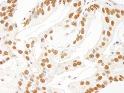 KSRP Polyclonal Antibody, Bethyl Laboratories 100 &mu;L; Unconjugated:Antibodies,
