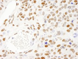 KSRP Polyclonal Antibody, Bethyl Laboratories 100 &mu;L; Unconjugated:Antibodies,