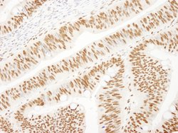 KSRP Polyclonal Antibody, Bethyl Laboratories:Antibodies:Primary Antibodies