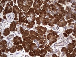 KYNU Monoclonal Antibody (OTI1F1), TrueMAB , OriGene 100 &mu;L | Buy Online | OriGene | Fisher Scientific