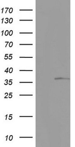 KYNU Mouse anti-Human, Clone: OTI1F1, lyophilized, TrueMAB 100 &mu;g; Unconjugated:Antibodies,