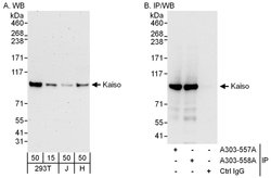 Kaiso Rabbit anti-Human, Polyclonal, Bethyl Laboratories 100 &mu;l; Unlabeled:Antibodies,