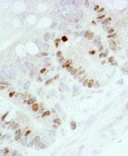 Ki-67 Polyclonal Antibody, Bethyl Laboratories 10 &mu;L | Buy Online | Bethyl Laboratories, Inc | Fisher Scientific
