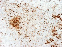 Ki-67 Polyclonal Antibody, Bethyl Laboratories 10 &mu;L | Buy Online | Bethyl Laboratories, Inc | Fisher Scientific