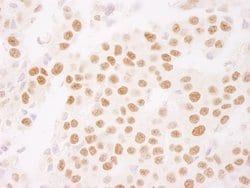 Ki-67 Polyclonal Antibody, Bethyl Laboratories 10 &mu;L; Unconjugated:Antibodies,