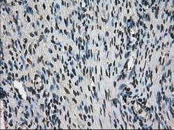 Ki67 Mouse anti-Human, Clone: OTI3D11, liquid, TrueMAB 100 &mu;L; Unconjugated:Antibodies,