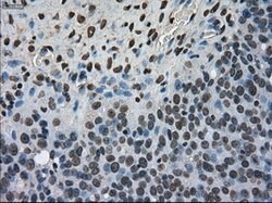 Ki67 Mouse anti-Human, Clone: OTI3D11, liquid, TrueMAB 100 &mu;L; Unconjugated:Antibodies,