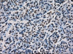 Ki67 Mouse anti-Human, Clone: OTI3D11, liquid, TrueMAB 100 &mu;L; Unconjugated:Antibodies,
