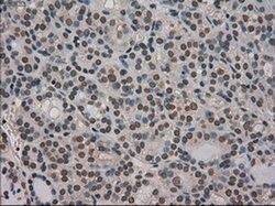 Ki67 Mouse anti-Human, Clone: OTI3D11, liquid, TrueMAB 100 &mu;L; Unconjugated:Antibodies,