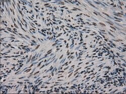 Ki67 Mouse anti-Human, Clone: OTI3D11, liquid, TrueMAB 100 &mu;L; Unconjugated:Antibodies,