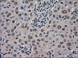Ki67 Mouse anti-Human, Clone: OTI3D11, liquid, TrueMAB 100 &mu;L; Unconjugated:Antibodies,