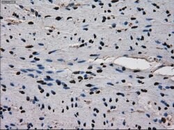 Ki67 Mouse anti-Human, Clone: OTI3D11, liquid, TrueMAB 100 &mu;L; Unconjugated:Antibodies,