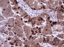 Ki67 Monoclonal Antibody (OTI8H5), TrueMAB , OriGene:Antibodies:Primary