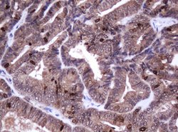 Ki67 Mouse anti-Human, Clone: OTI8H5, lyophilized, TrueMAB 100 &mu;g; Unconjugated:Antibodies,