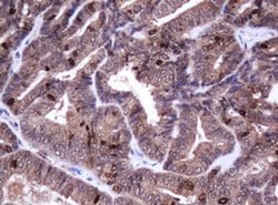 Ki67 Monoclonal Antibody (OTI8H5), TrueMAB , OriGene 100 &mu;L; Unconjugated:Antibodies,