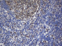 Ki67 Mouse anti-Human, Clone: OTI8H5, lyophilized, TrueMAB 100 &mu;g; Unconjugated:Antibodies,