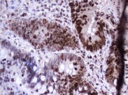 Ki67 Mouse anti-Human, Clone: OTI8H5, lyophilized, TrueMAB 100 &mu;g; Unconjugated:Antibodies,