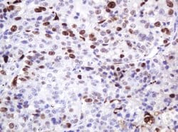 Ki67 Mouse anti-Human, Clone: OTI9H7, liquid, TrueMAB 100 &mu;L; Unconjugated:Antibodies,
