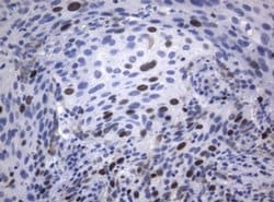 Ki67 Monoclonal Antibody (OTI9C3), TrueMAB , OriGene 100 &mu;L; Unconjugated:Antibodies,