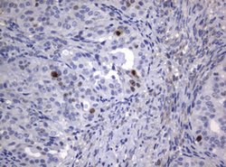 Ki67 Monoclonal Antibody (OTI9C3), TrueMAB , OriGene 100 &mu;L; Unconjugated:Antibodies,