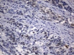 Ki67 Monoclonal Antibody (OTI9C3), TrueMAB , OriGene 100 &mu;L; Unconjugated:Antibodies,