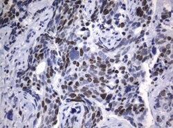 Ki67 Monoclonal Antibody (OTI9C3), TrueMAB , OriGene 100 &mu;L; Unconjugated:Antibodies,