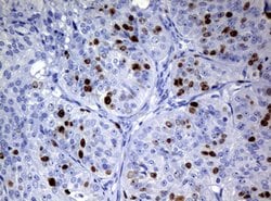 Ki67 Rat anti-Human, Clone: OTI3B6, lyophilized, TrueMAB 100 &mu;g; Unconjugated:Antibodies,
