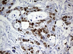 Ki67 Rat anti-Human, Clone: OTI3B6, lyophilized, TrueMAB 100 &mu;g; Unconjugated:Antibodies,