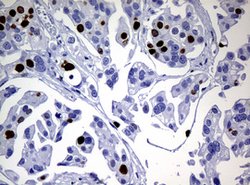 Ki67 Rat anti-Human, Clone: OTI3B6, lyophilized, TrueMAB 100 &mu;g; Unconjugated:Antibodies,