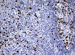 Ki67 Rat anti-Human, Clone: OTI3B6, lyophilized, TrueMAB 100 &mu;g; Unconjugated:Antibodies,