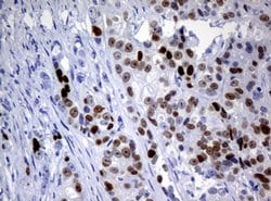 Ki67 Rat anti-Human, Clone: OTI3B6, lyophilized, TrueMAB 100 &mu;g; Unconjugated:Antibodies,