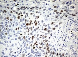 Ki67 Rat anti-Human, Clone: OTI5D7, liquid, TrueMAB 100 &mu;L; Unconjugated:Antibodies,