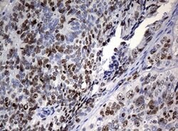 Ki67 Rat anti-Human, Clone: OTI5D7, liquid, TrueMAB 100 &mu;L; Unconjugated:Antibodies,