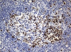 Ki67 Rat anti-Human, Clone: OTI5D7, liquid, TrueMAB 100 &mu;L; Unconjugated:Antibodies,