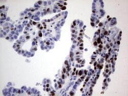 Ki67 Monoclonal Antibody (OTI6C12), TrueMAB , OriGene 100 &mu;L; Unconjugated:Antibodies,