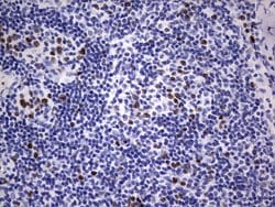 Ki67 Monoclonal Antibody (OTI6C12), TrueMAB , OriGene 100 &mu;L; Unconjugated:Antibodies,