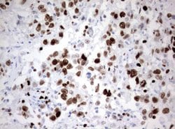 Ki67 Monoclonal Antibody (OTI9H1), TrueMAB , OriGene 100 &mu;L; Unconjugated:Antibodies,